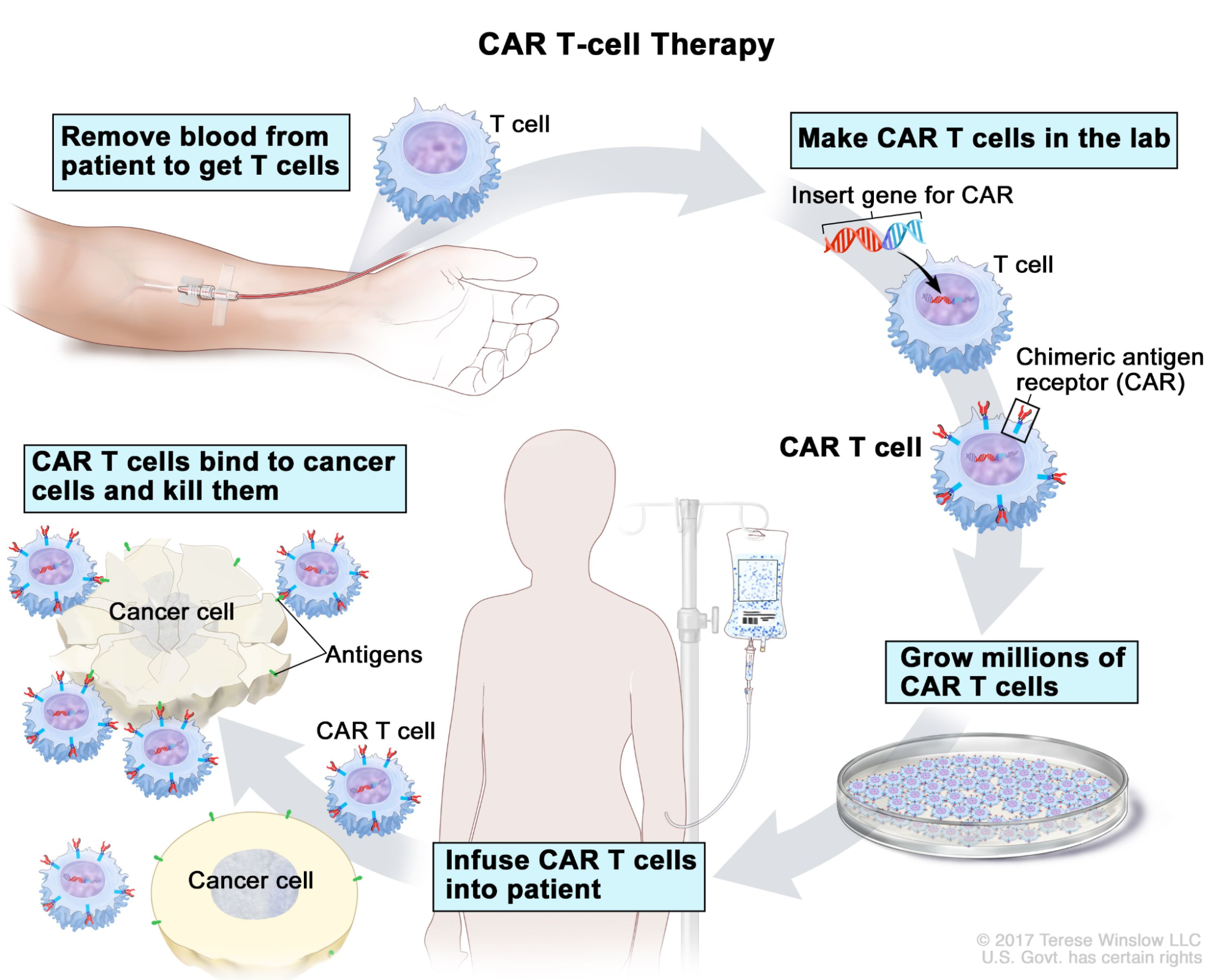 CAR T-Cell_Therapy